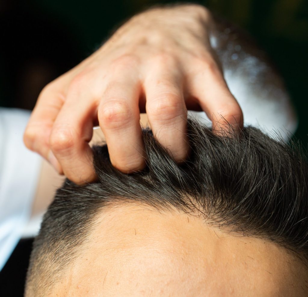 cuando empieza a crecer el pelo injertado