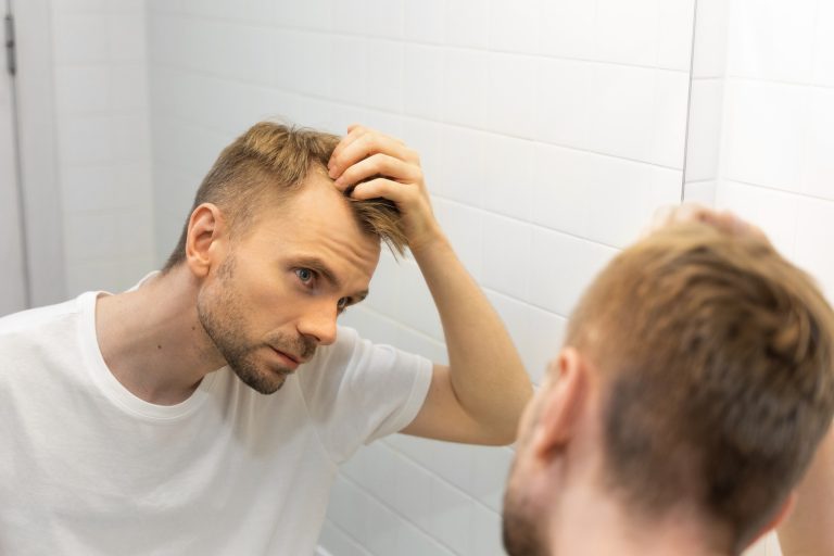Hombre rubio revisándose la entrada del pelo frente al espejo tras un injerto capilar